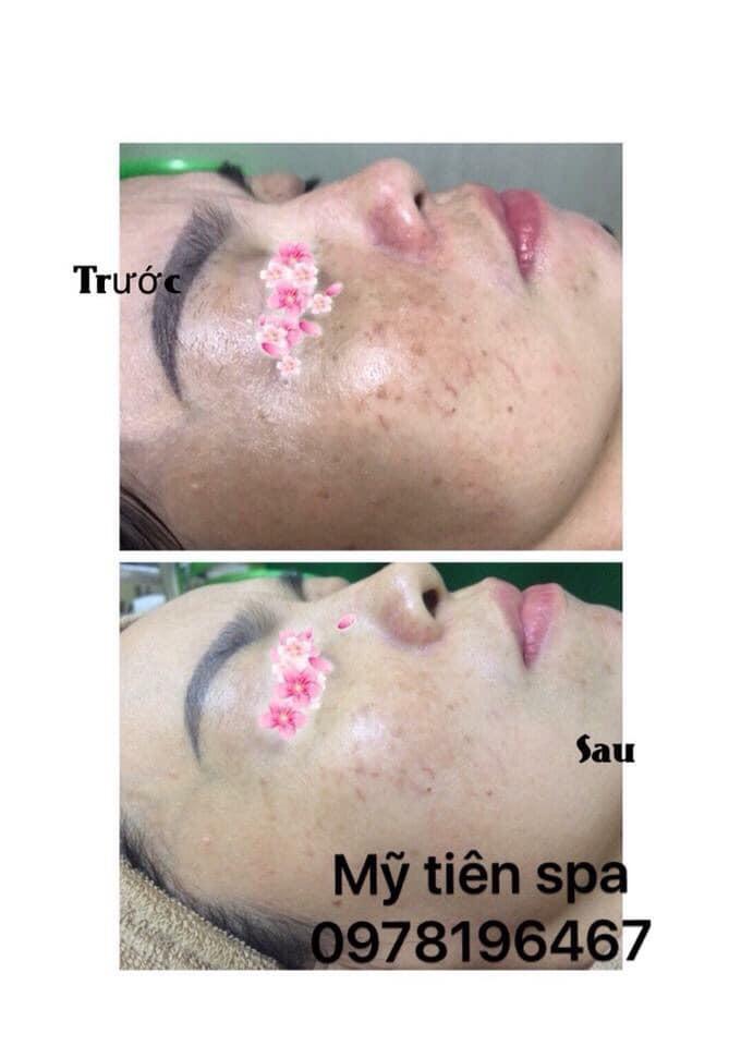 Mỹ Tiên Spa Bến Tre