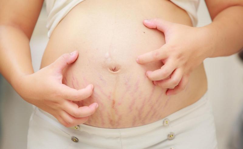 Mẹ bầu có tiền sử da khô hoặc mắc chứng chàm bội nhiễm.