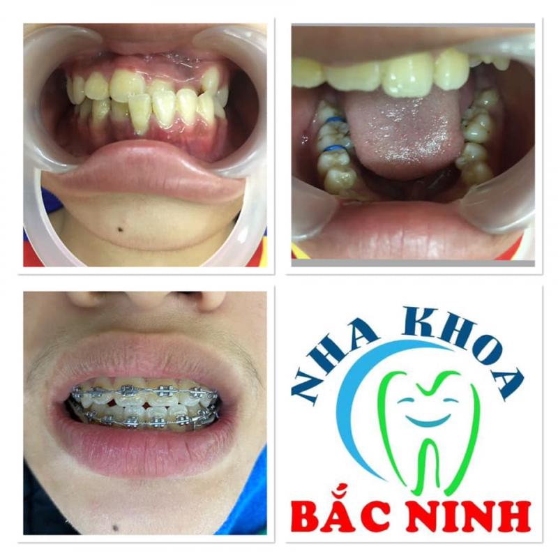 Nha khoa Bắc Ninh
