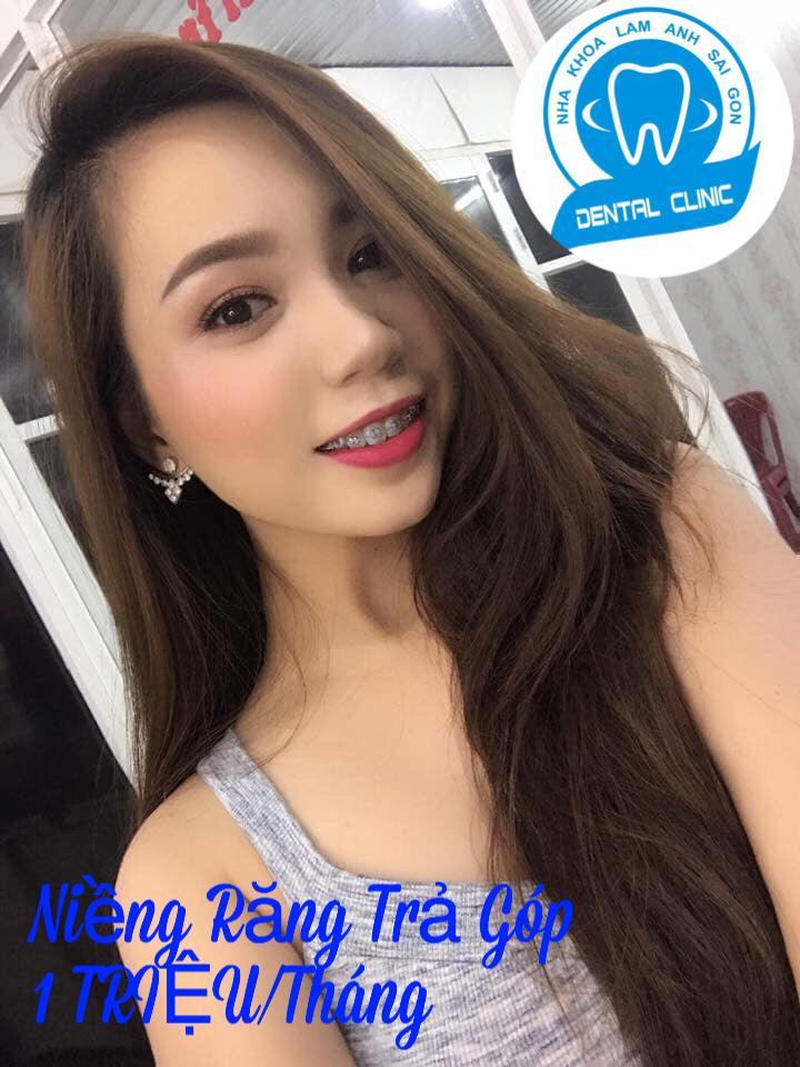 Nha Khoa Lan Anh Sài Gòn