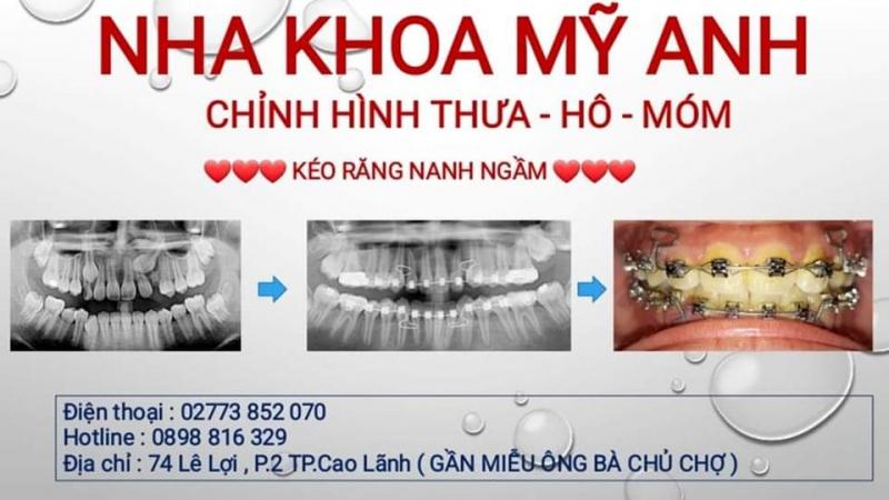 Nha Khoa Mỹ Anh