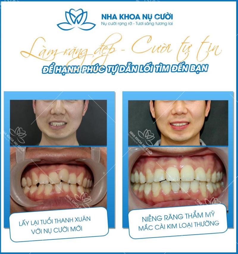 Nha Khoa Nụ Cười