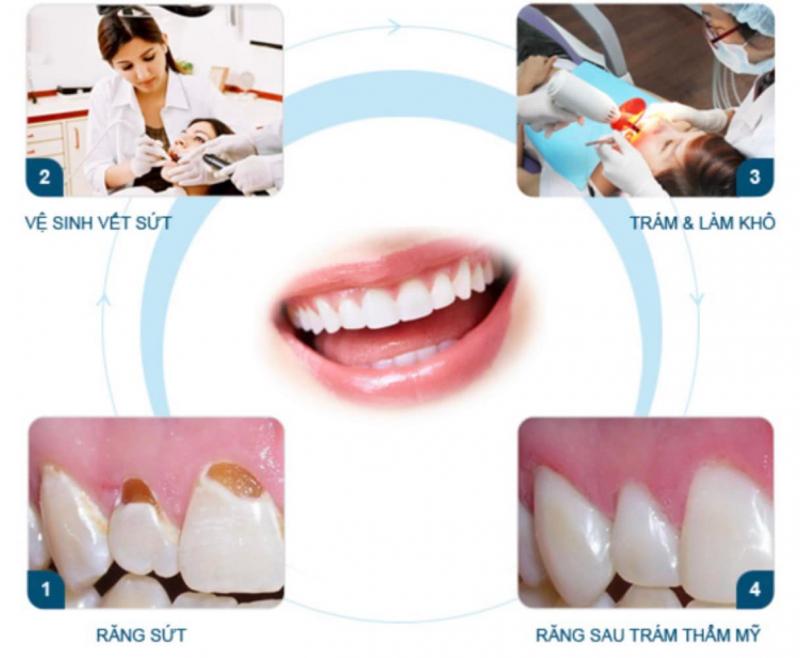 Nha Khoa Nụ Cười Xinh