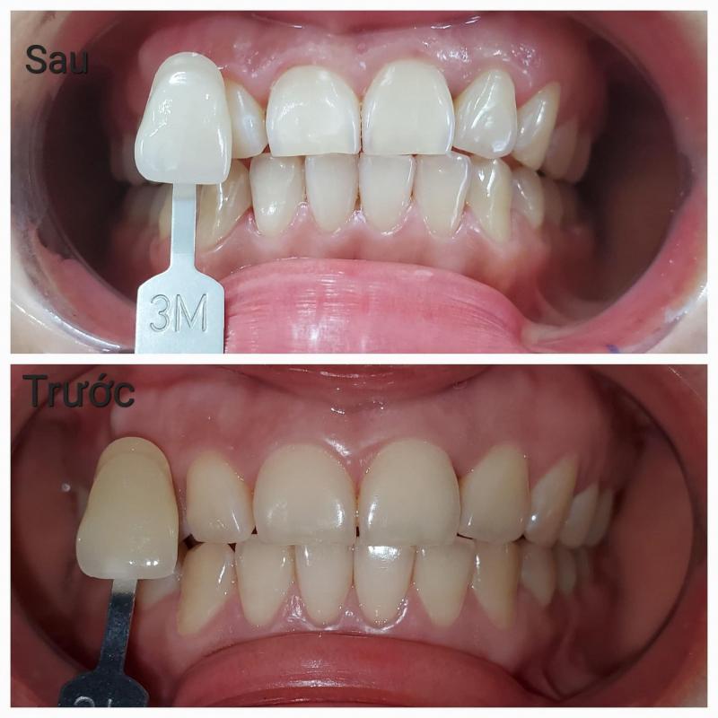 Nha Khoa Phương Kiến Đức
