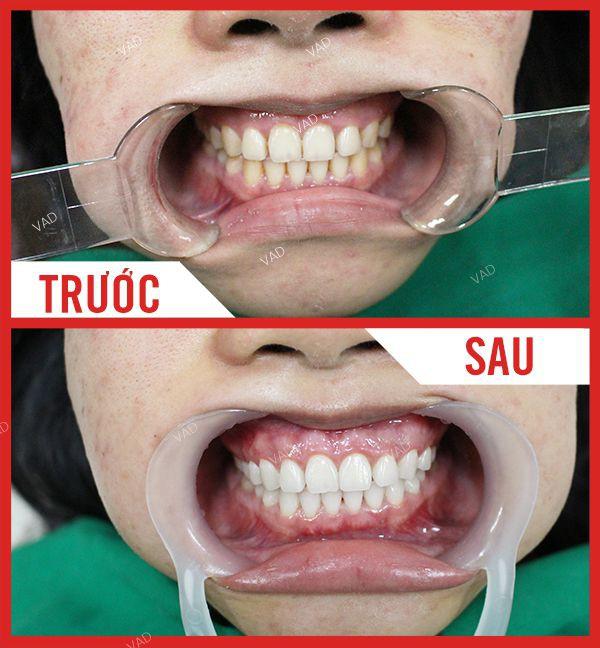 Nha Khoa Sài Gòn Bến Thành Chi Nhánh Phú Yên