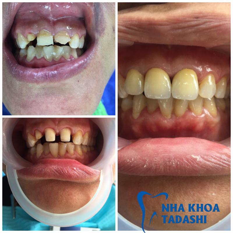 Nha khoa thẩm mỹ Tadashi Thanh Hóa