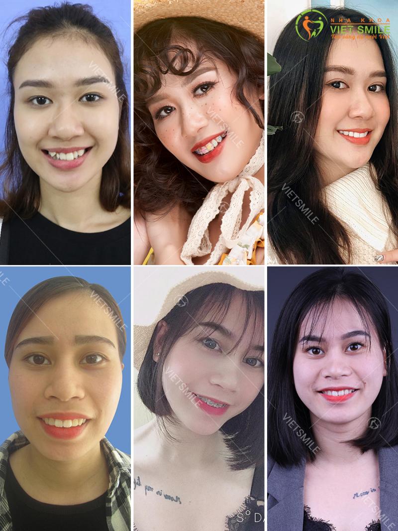 Nha khoa VIET SMILE