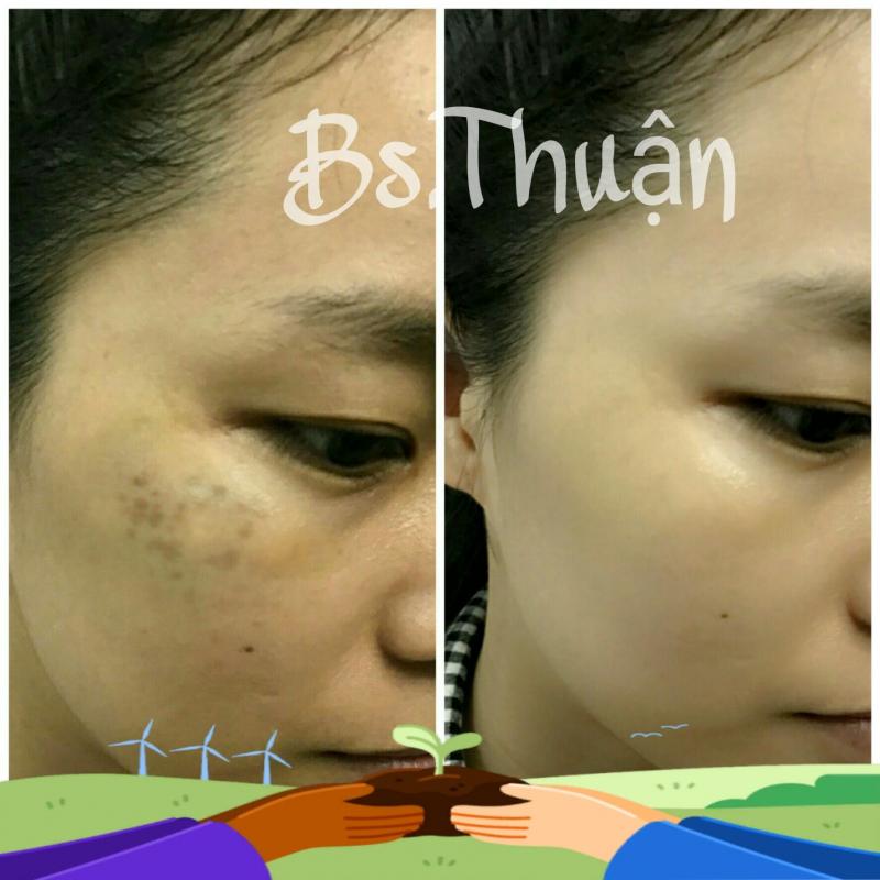﻿Phòng Khám Bác Sĩ Thuận CKII Da Liễu