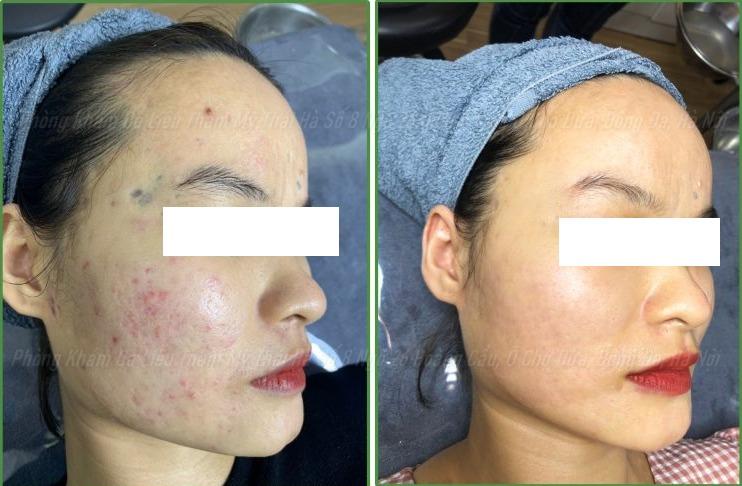 Phòng khám da liễu - Bác sỹ Thái Hà (Dr.thaiha)