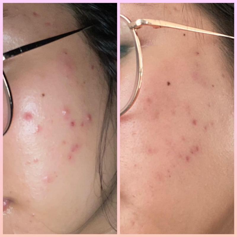 Phòng Khám Da liễu Bs Hải Lý