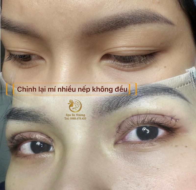 Spa Bác sỹ Nương - Làm đẹp Công Nghệ Cao