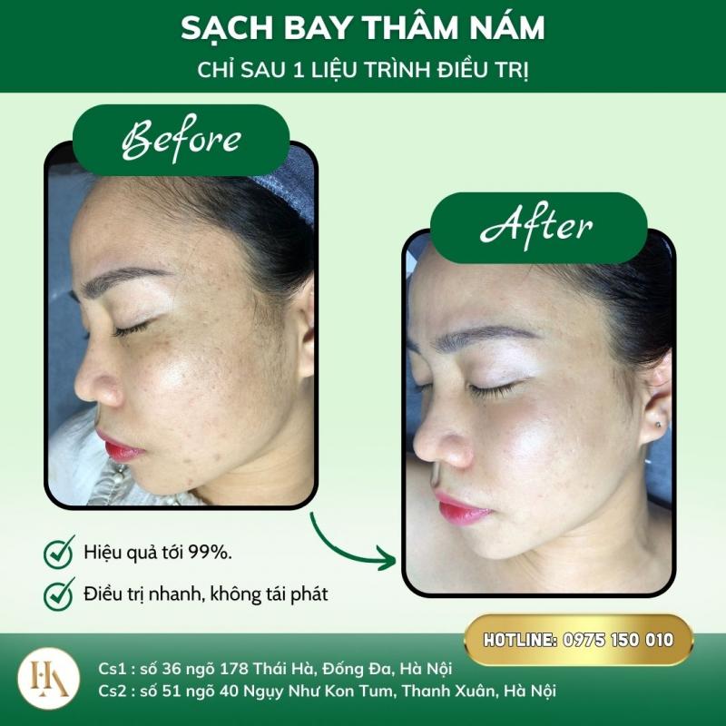 Spa Hải Anh