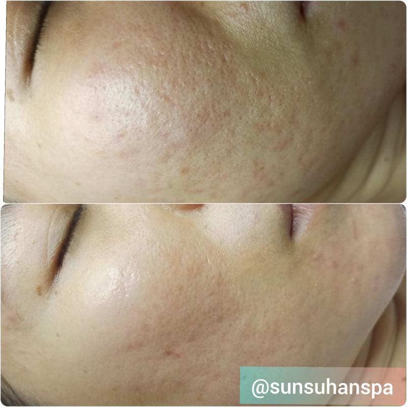Sunsuhan Spa Cần Thơ