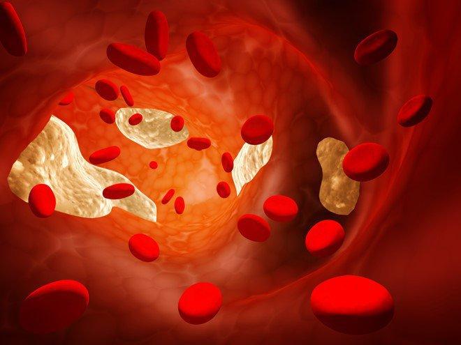 Tăng cholesterol có hại