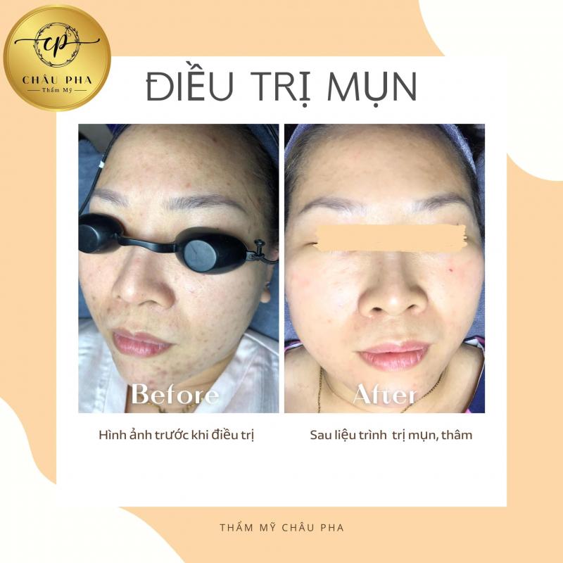 Thẩm mỹ Châu Pha