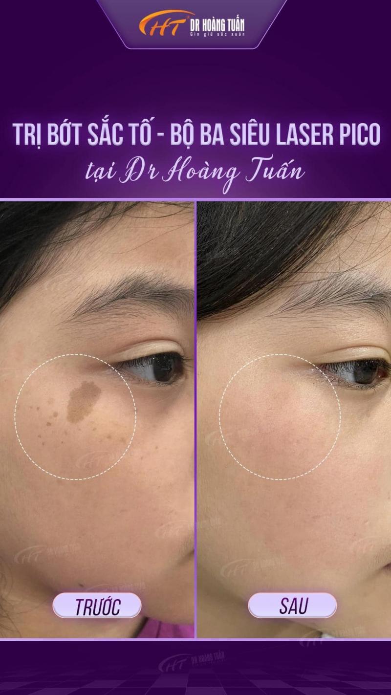 Thẩm mỹ Hoàng Tuấn