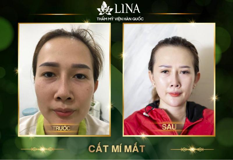 Thẩm Mỹ Lina