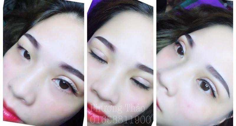 Thẩm mỹ Phương Thảo