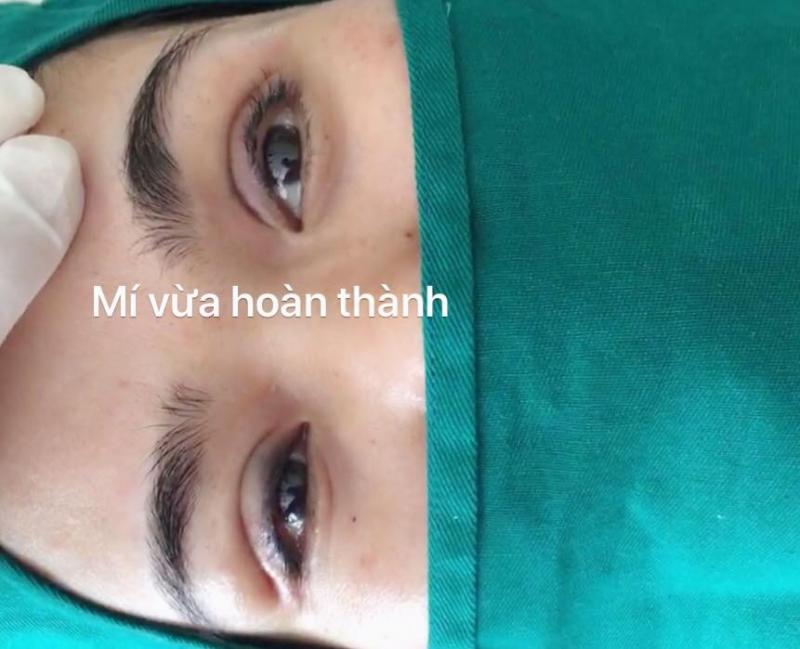 Thẩm mỹ Quang Tú