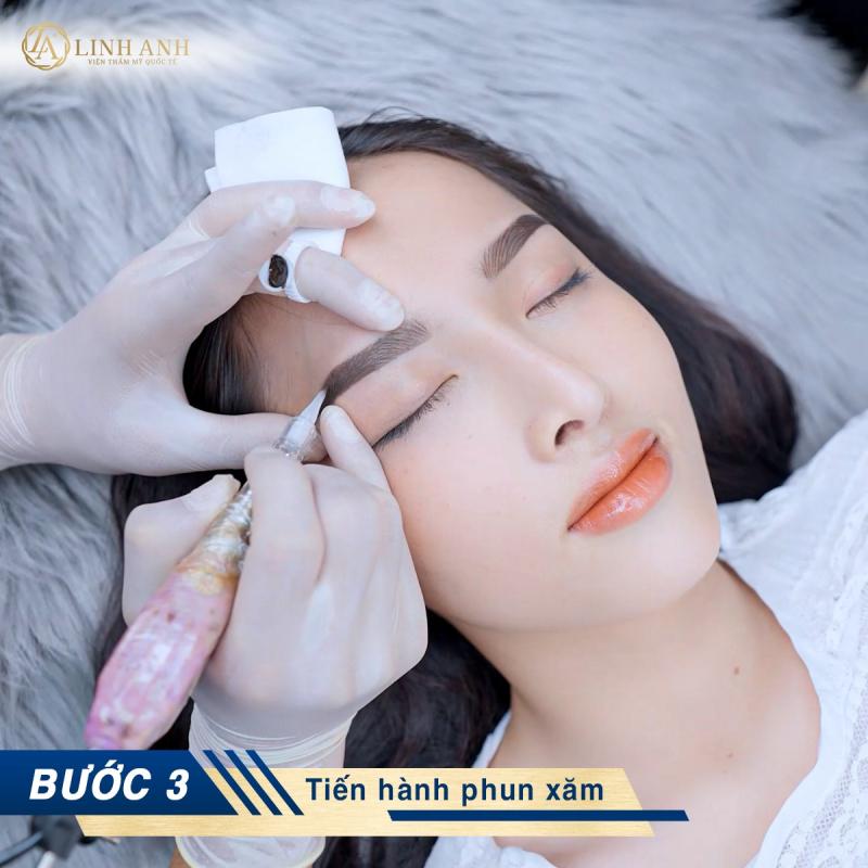 Thẩm mỹ Quốc tế Linh Anh