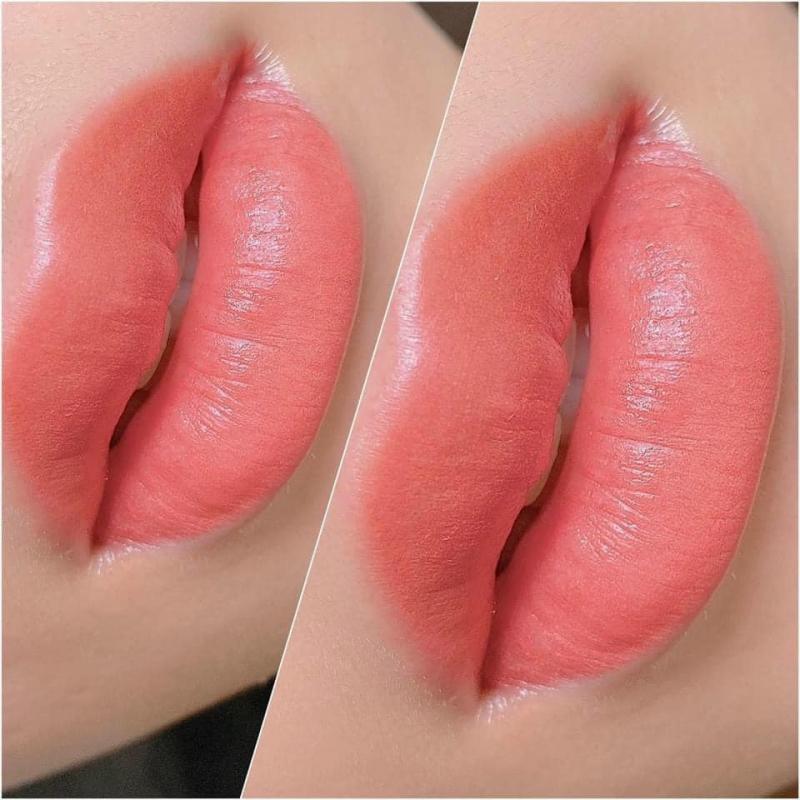 Thẩm mỹ Quốc tế Như Ý
