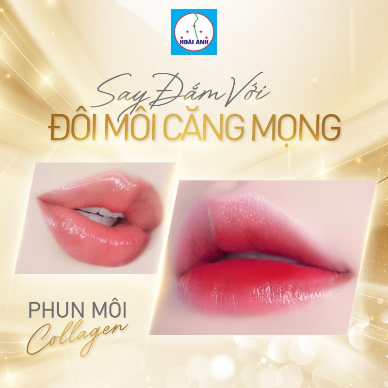 Thẩm mỹ viện Hoài Anh