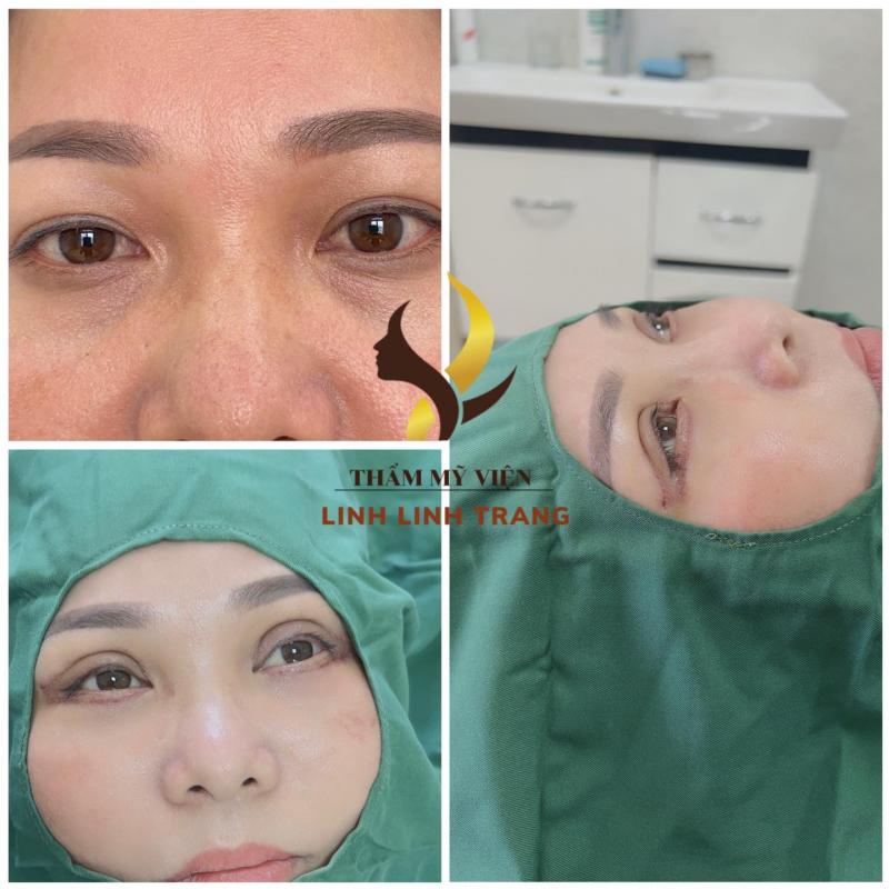 Thẩm mỹ viện Linh Linh Trang