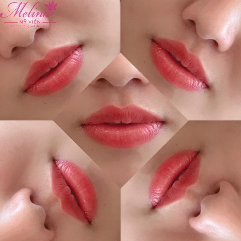 Thẩm Mỹ Viện Melina