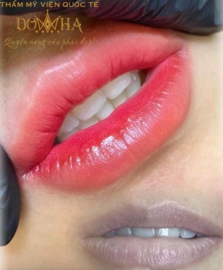 Thẩm mỹ Quốc tế DOWHA