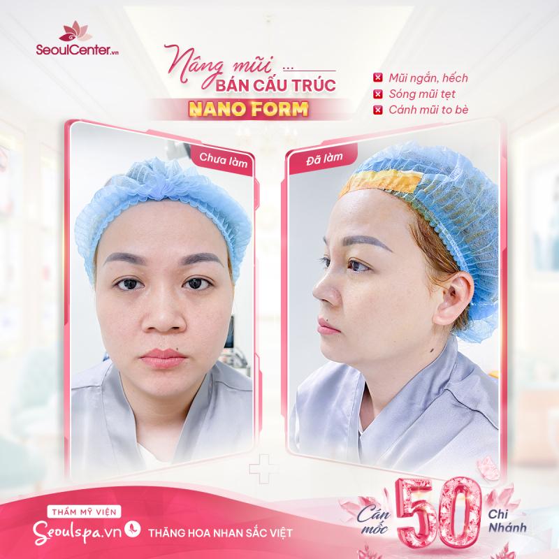 Thẩm Mỹ Viện SeoulSpa.Vn Quy Nhơn