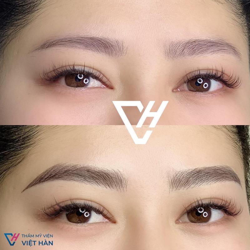 Thẩm Mỹ Viện Việt Hàn