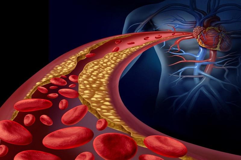 Theo dõi hàm lượng cholesterol trong máu