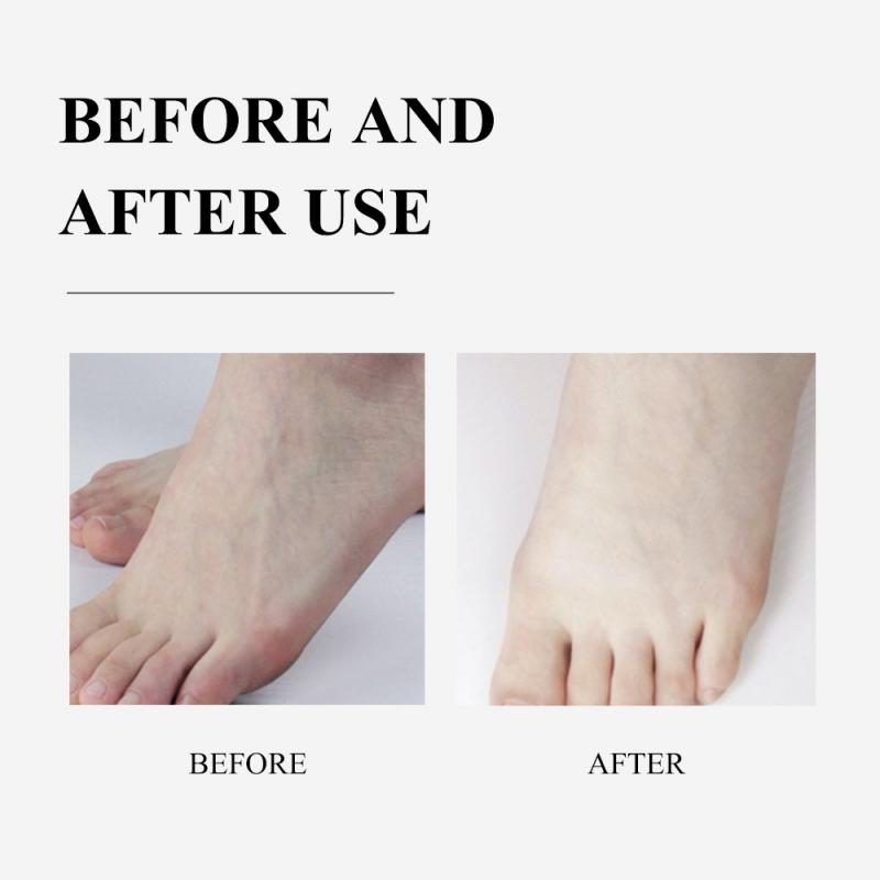 Sau khi sử dụng túi ủ mặt nạ chân Breylee