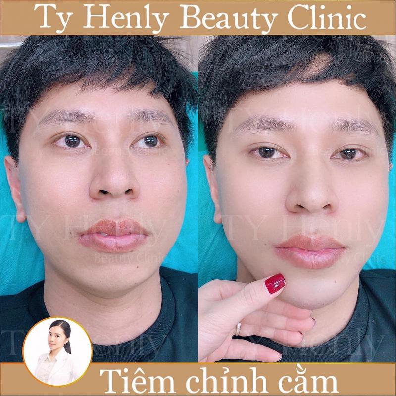 Ty Henly Beauty Clinic