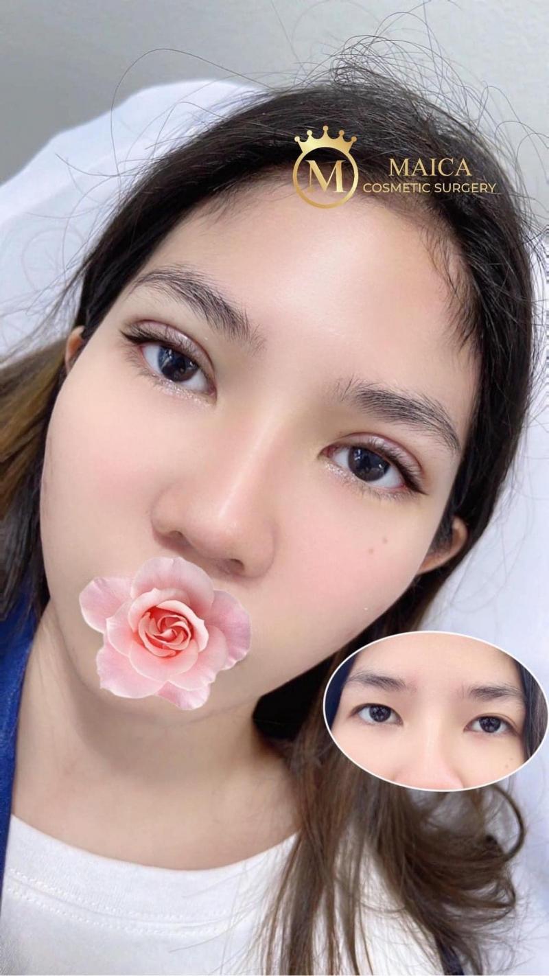 Viện Thẩm Mỹ Maica Beauty Center
